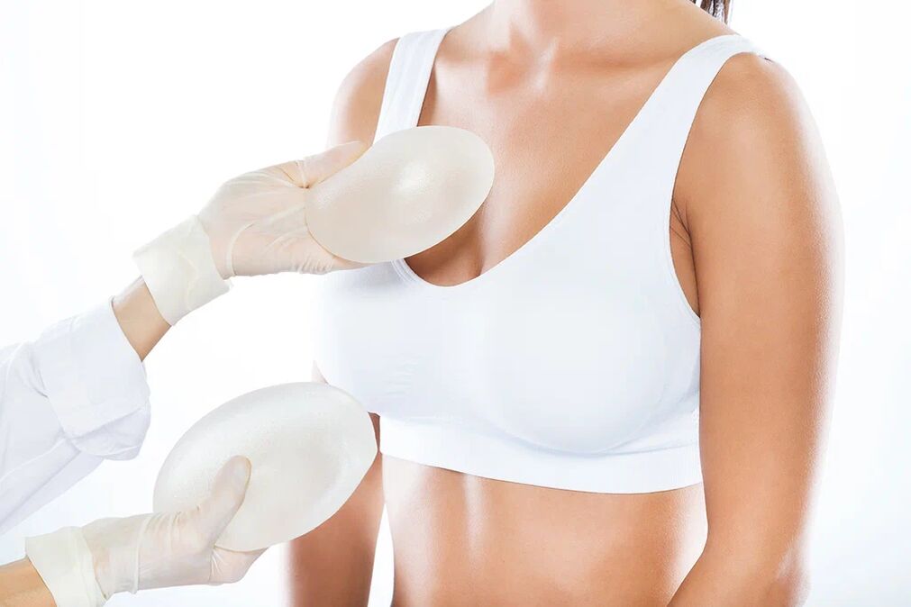Elixir implantes antes da cirurxía de aumento de mama