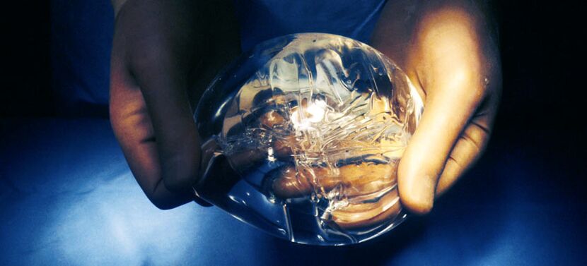 Endoprótese de silicona