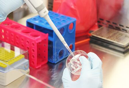 Revisión das probas dos pacientes antes de realizar a mamoplastia de aumento